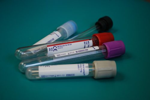 testy z krwi